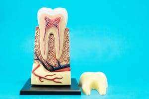 root canals 