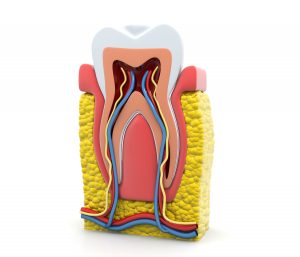 newhall root canal