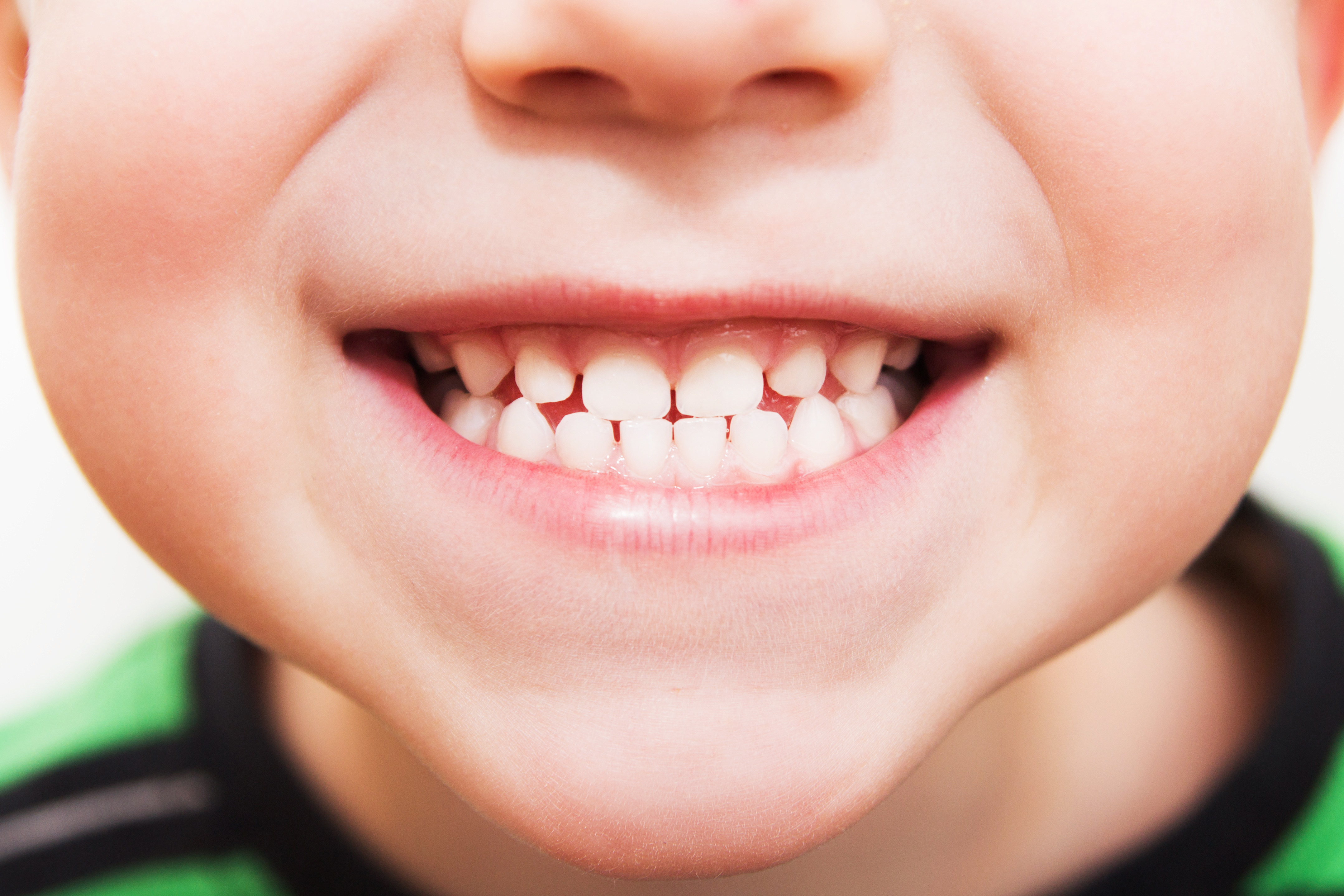 Ребенок без молочных зубов. Красивые зубы у детей. Неправильный прикус у ребенка. Ровные зубы у детей.