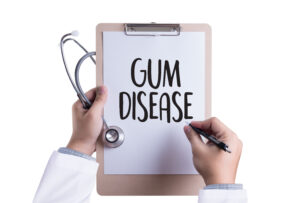 newhall gum disease treatment