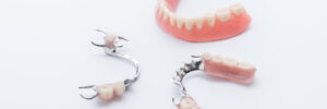 newhall partial denture