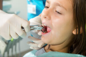 newhall tooth extraction