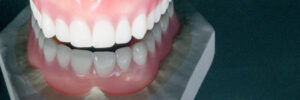newhall custom dentures