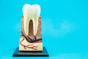 newhall root canal